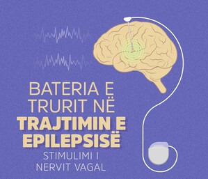 Trajtimi i Epilepsisë me Baterinë e Trurit